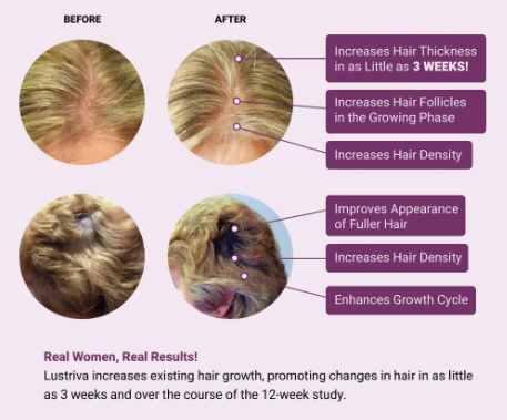 HAIR GROWTH