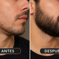 Sérum para Barba – Beard Growth Serum